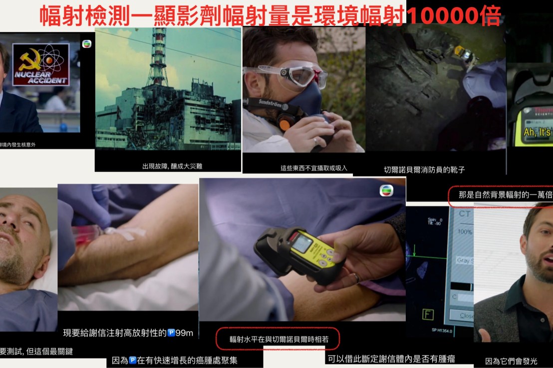 輻射、顯影劑會打死人！咁點解仲要用？